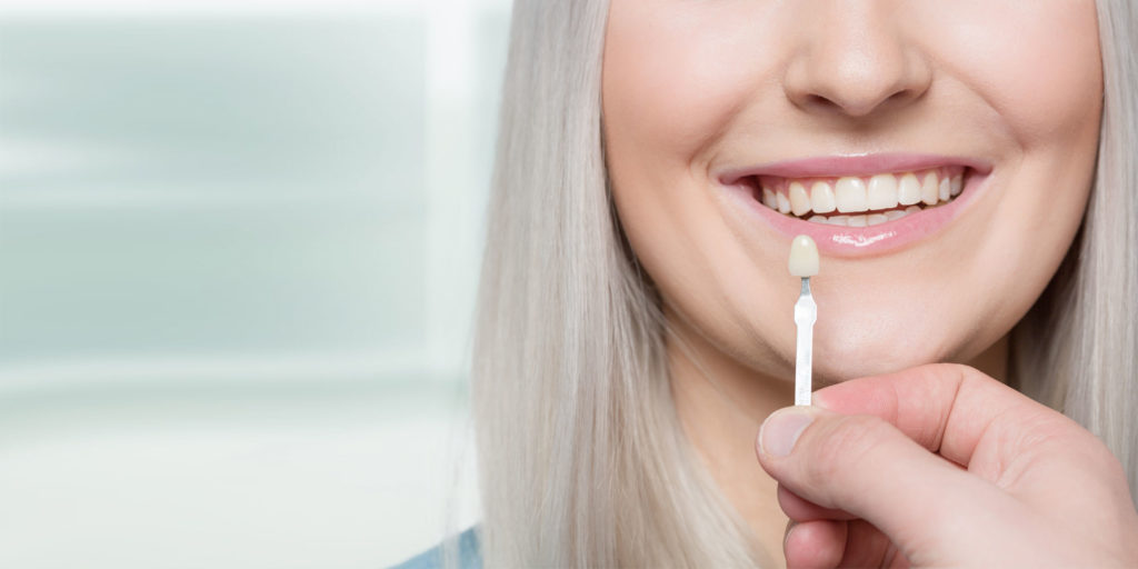 dental veneers patient smiling