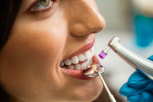 Closeup shot of a women getting a teeth whitening treatment, young woman patient.