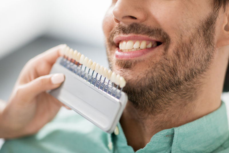 Dentist comparing a patient's teeth to a tooth shade guide to plan teeth whitening or restorative dental treatment.